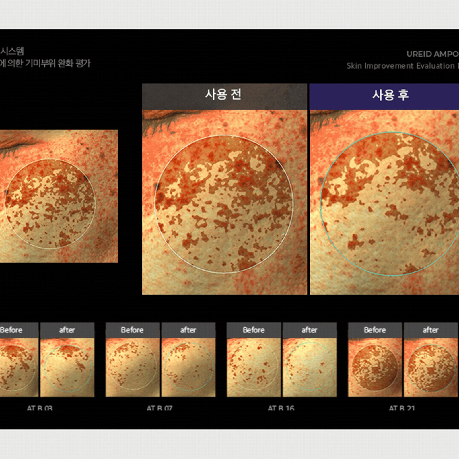 비에논 우레이드 기미앰플 검버섯 흑자 나이아신아마이드 미백앰플 상세 이미지 1
