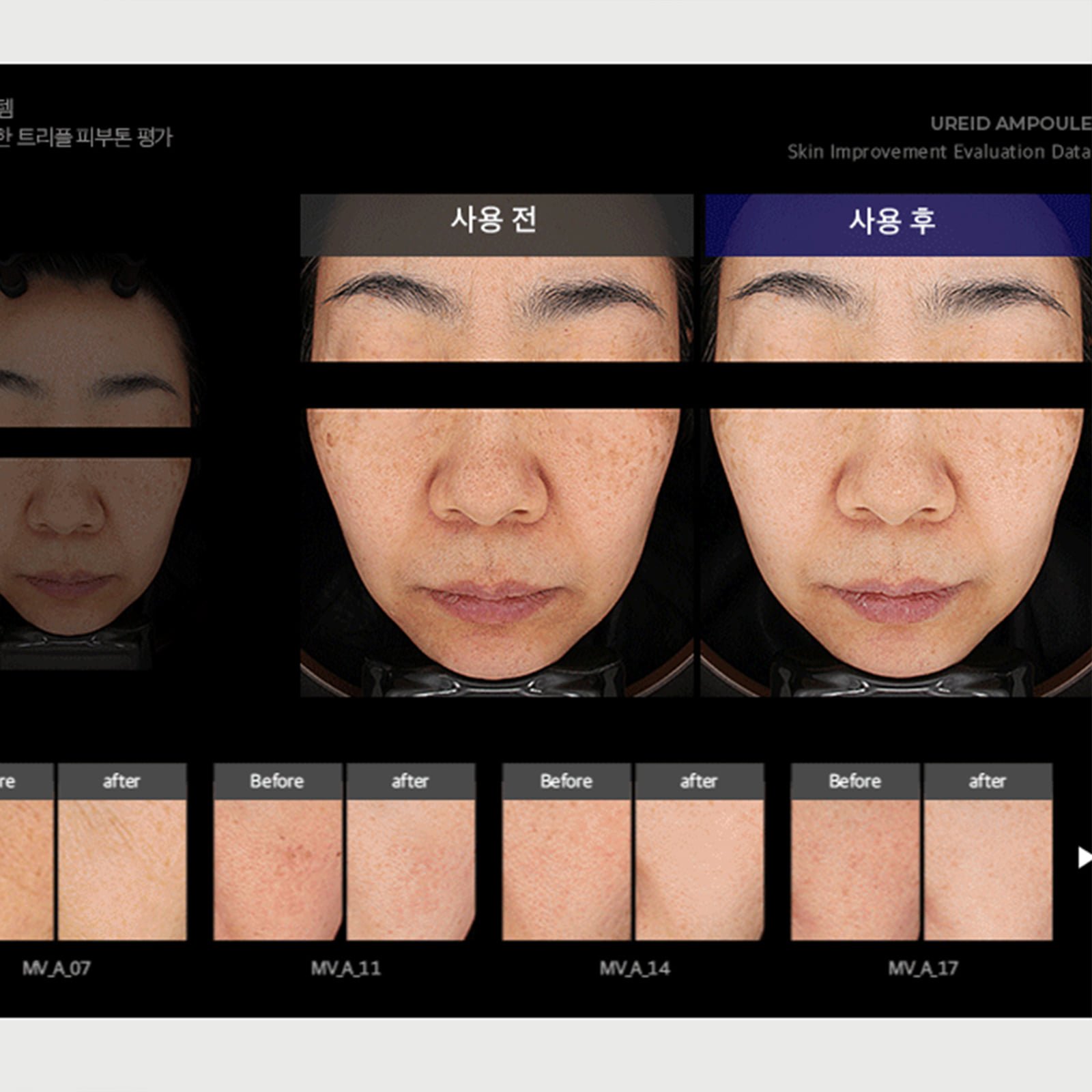 비에논 우레이드 기미앰플 검버섯 흑자 나이아신아마이드 미백앰플 상세 이미지 2